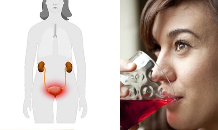 Urinary Tract Infections Biggest Causes (+11 All-Natural Ways to Treat Them)