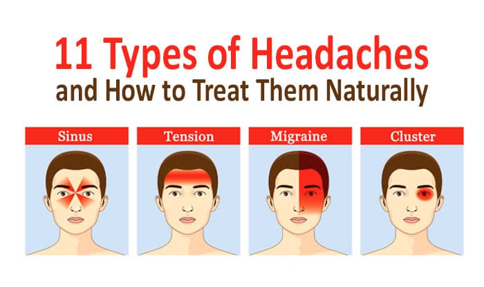 11 Types of Headaches and How to Treat Them Naturally