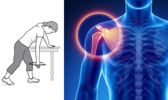 Frozen Shoulder (Adhesive Capsulitis): Causes, Symptoms, Diagnosis, Relief and Exercises