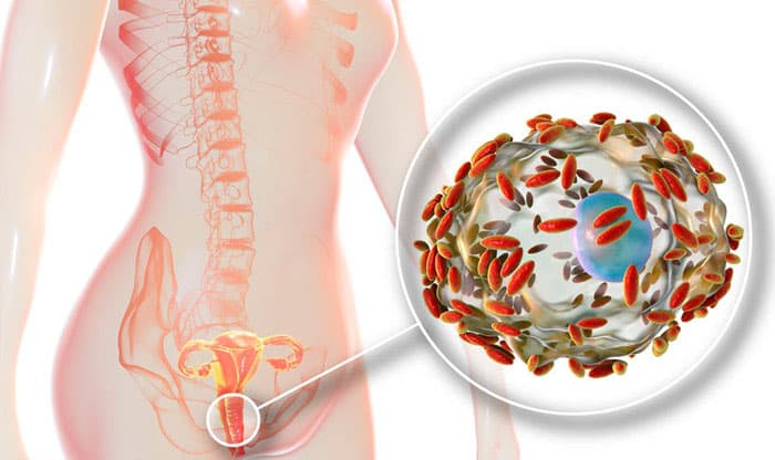 Bacterial Vaginosis – Cause, Symptoms, Treatment and Prevention