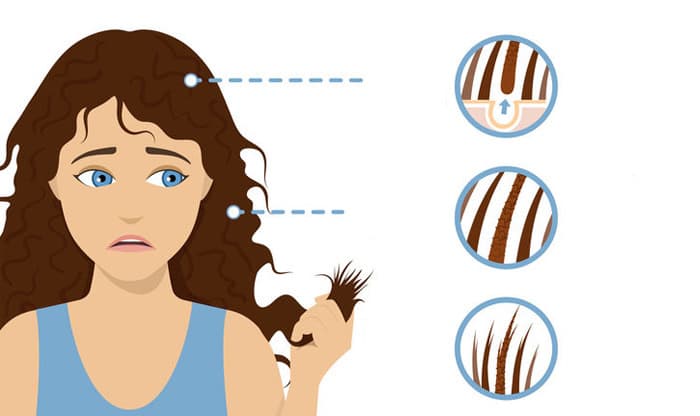 How to Prevent Hair Loss: 13 Tips to Help Save Your Hair